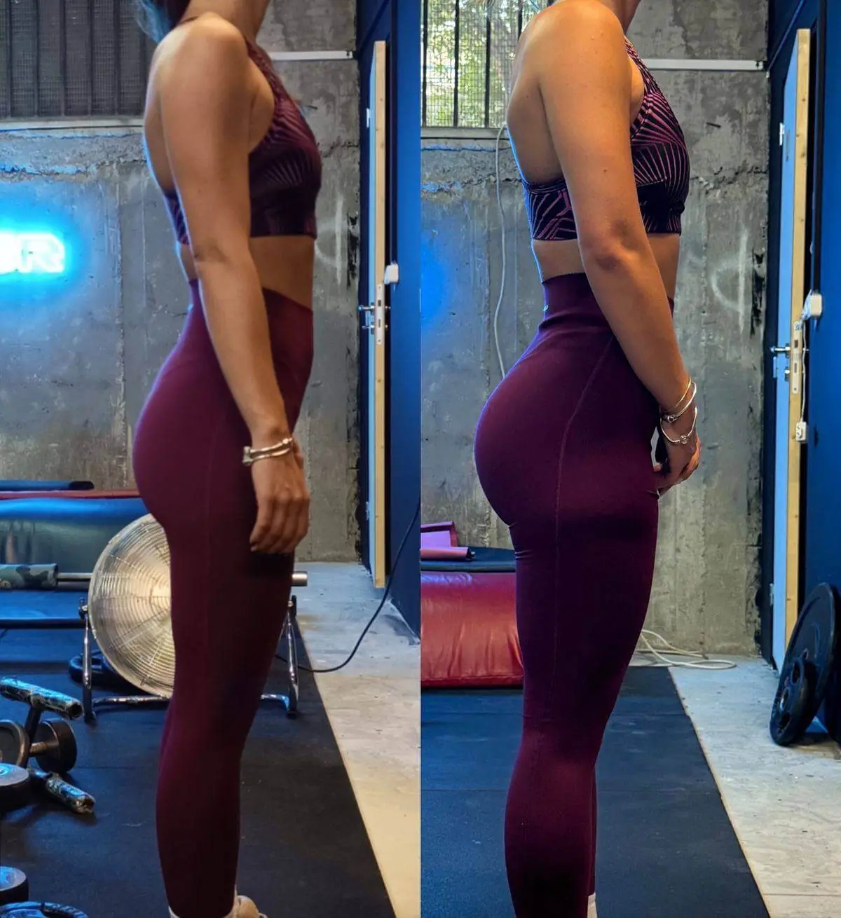 Antes e depois de Jenifer Miranda
